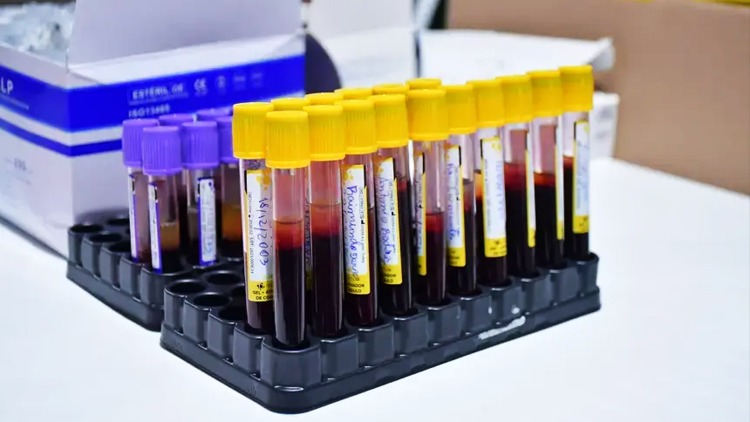 Governo do Amapá garante exames laboratoriais para candidatos do concurso da PM no Hospital de Clínicas Alberto Lima